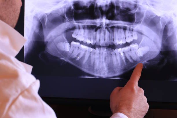 Best Chipped Tooth Repair Near Me  in Miami Gardens, FL